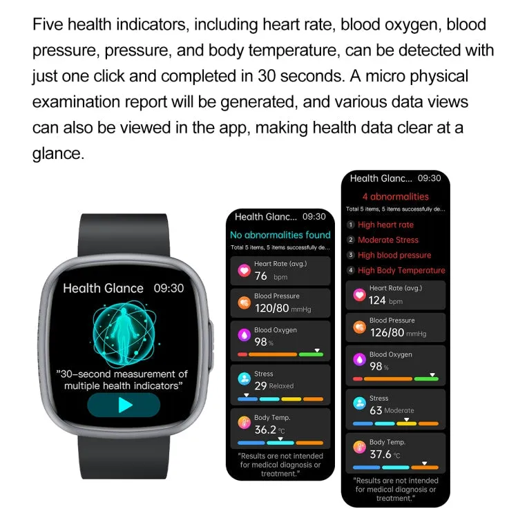 ET593 1.75 inch IPS Square Screen Smart Watch, ECG Electrocardiogram / Blood Sugar Monitoring(Blue)